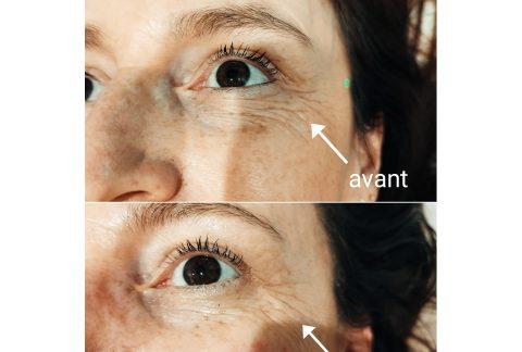 Massage Liftant Japonais