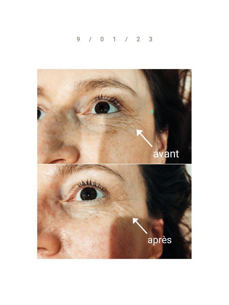 Offrez à votre visage un véritable lifting naturel grâce au Kobido : un soin qui tonifie, lisse et révèle tout l’éclat de votre peau.